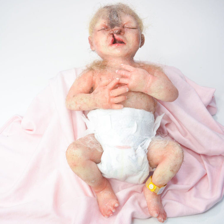Baby Werewolf with Cleft lip